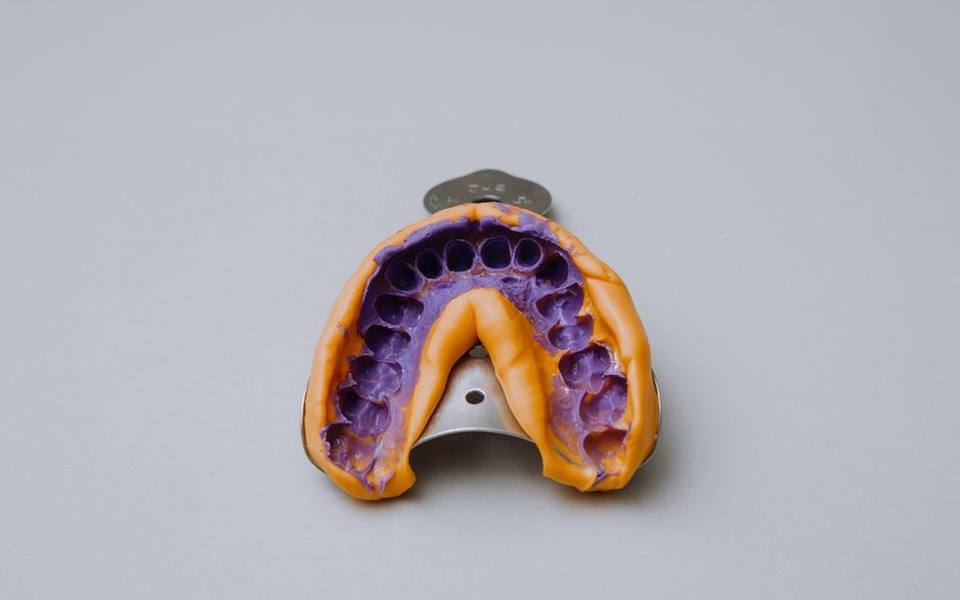 Audiologist Impressions Versus At-Home Molding Kits